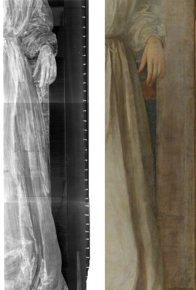 Radiograph next to photograph